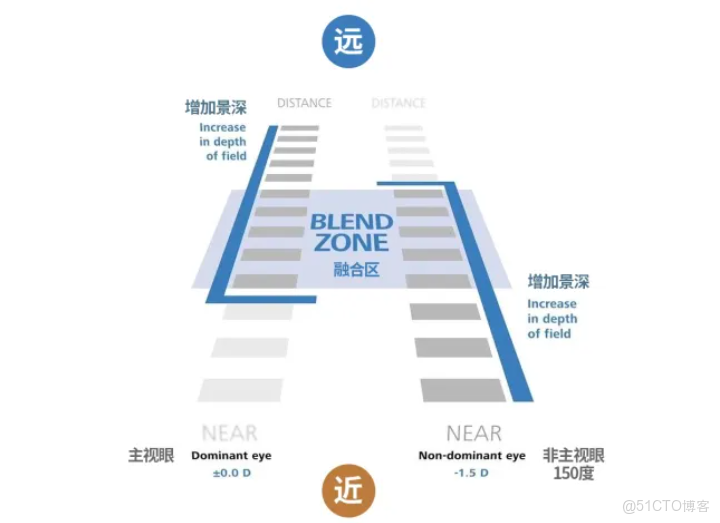 看遠看近都清晰，激光老視手術來幫您_工作效率_02