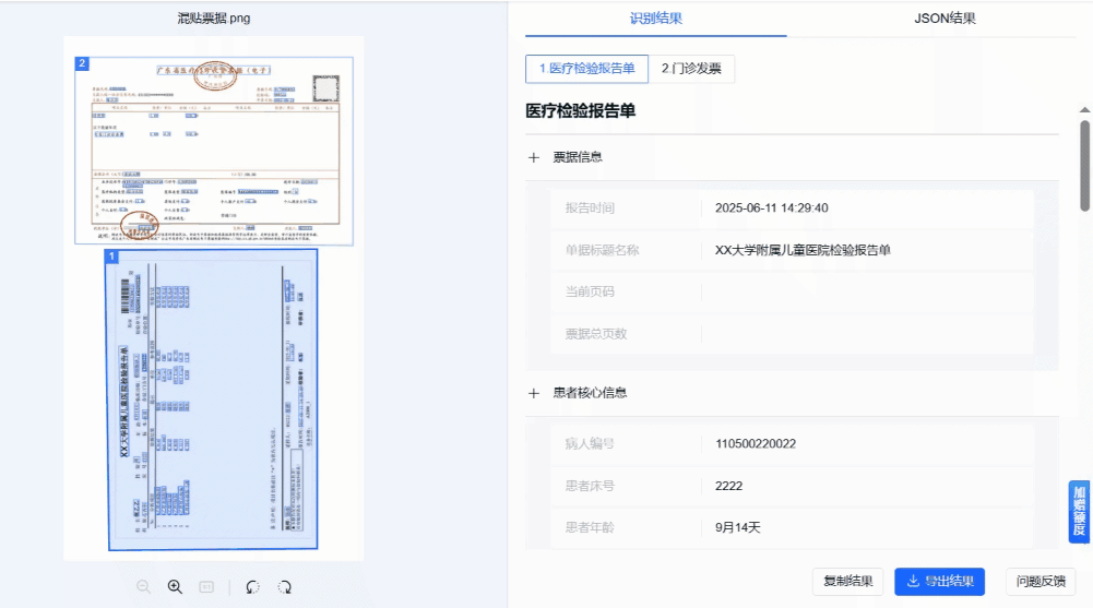 醫療票據識別工具推薦_圖像質量_03
