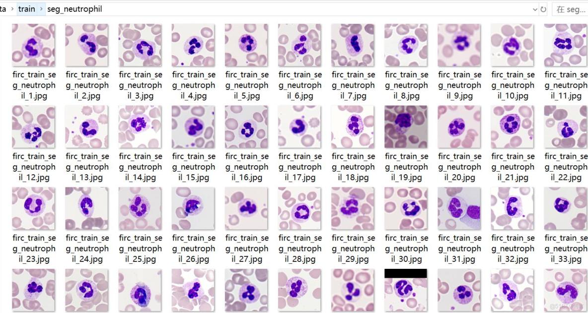 癌症檢測血細胞分類數據集499張5類別已劃分好訓練驗證測試集_目標檢測_05