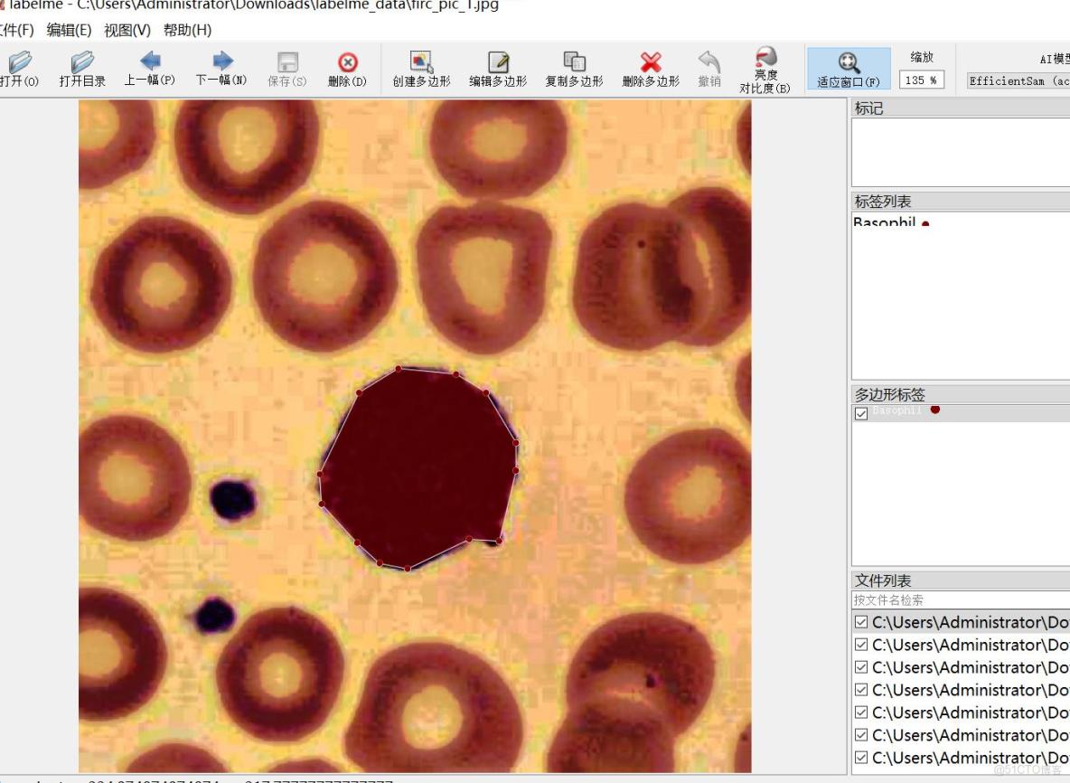 癌症檢測血細胞識別分割數據集labelme格式4918張5類別_json數據_05