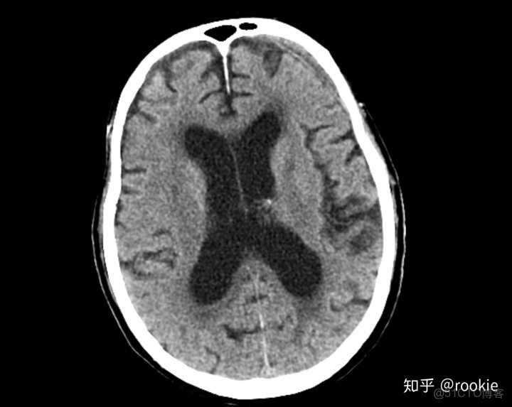 CLAHE算法增強局部對比度的X光圖像增強效果對比_f5_15