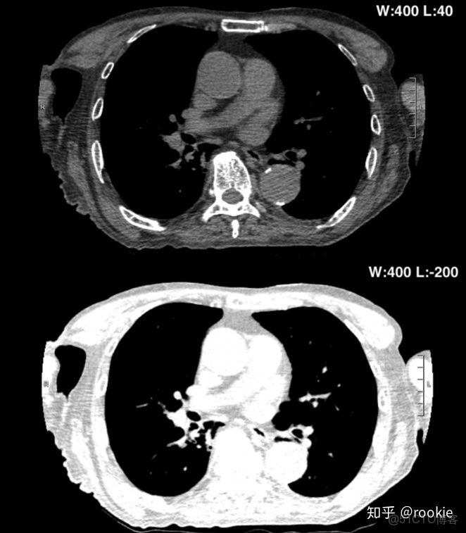 CLAHE算法增強局部對比度的X光圖像增強效果對比_ico_07