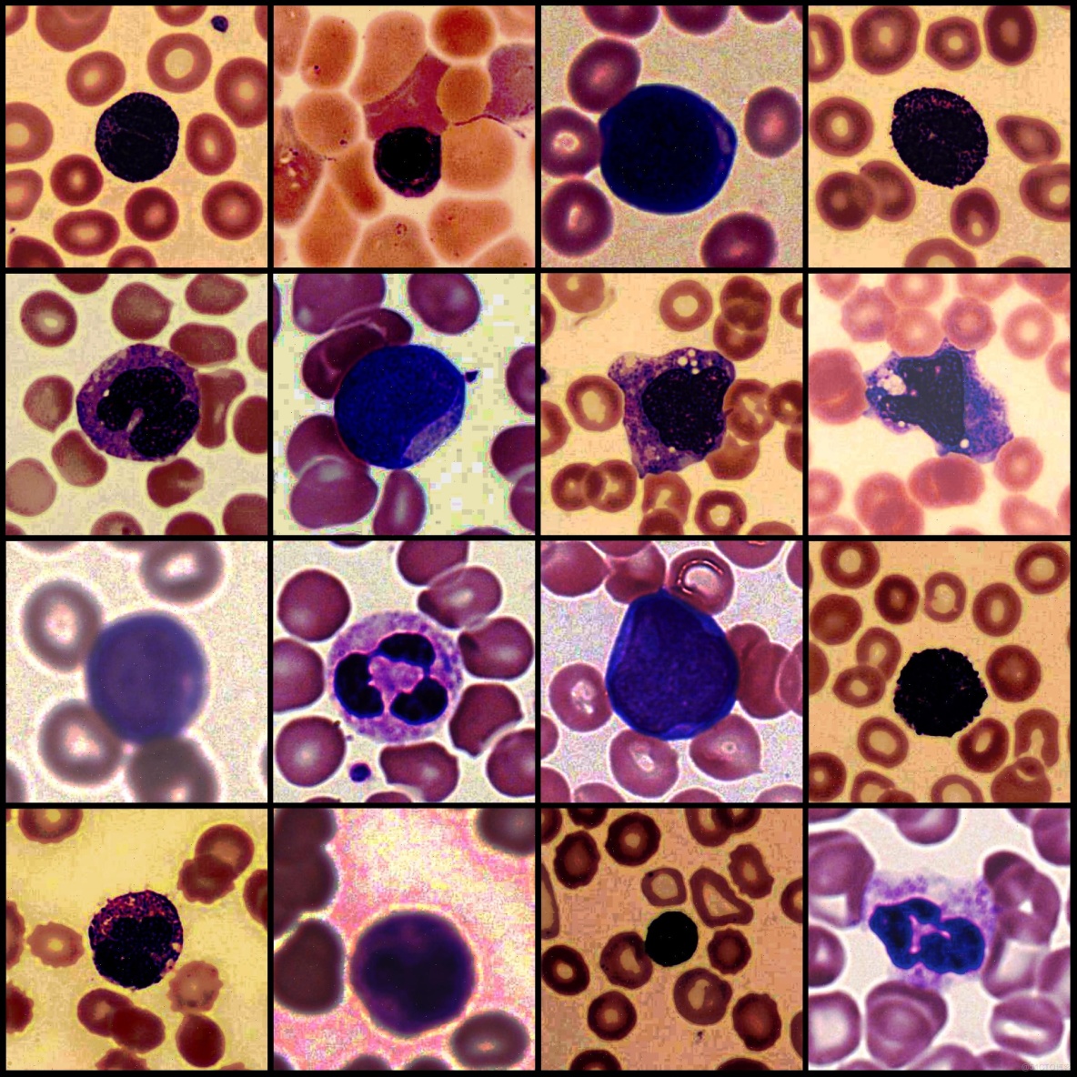 癌症檢測血細胞識別分割數據集labelme格式4918張5類別_json數據_03