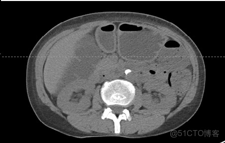 CLAHE算法增強局部對比度的X光圖像增強效果對比_#python 計算對比度_17