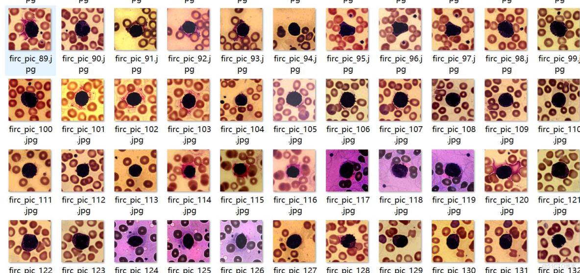 癌症檢測血細胞識別分割數據集labelme格式4918張5類別_json數據