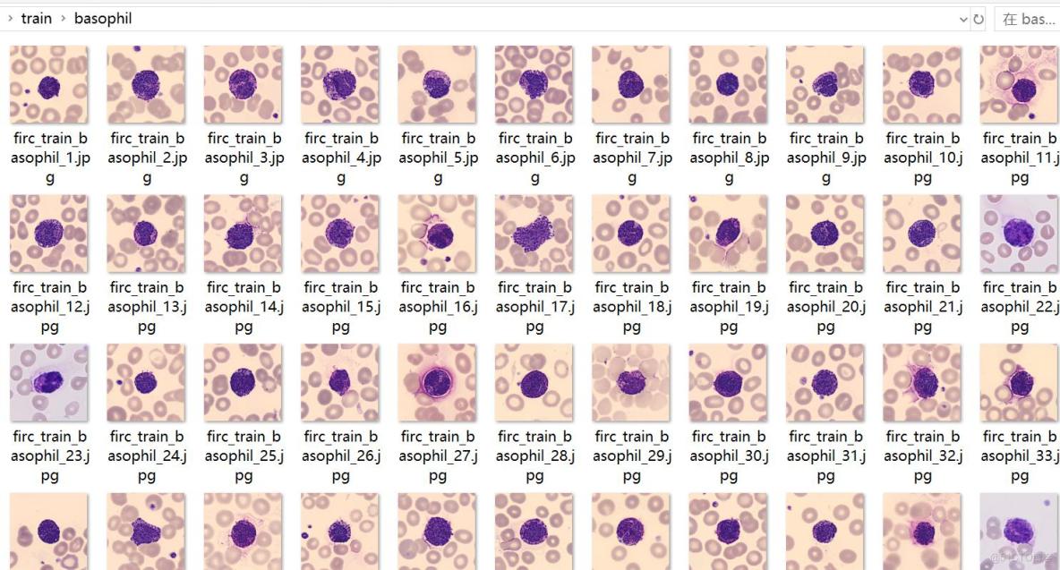 癌症檢測血細胞分類數據集499張5類別已劃分好訓練驗證測試集_數據集
